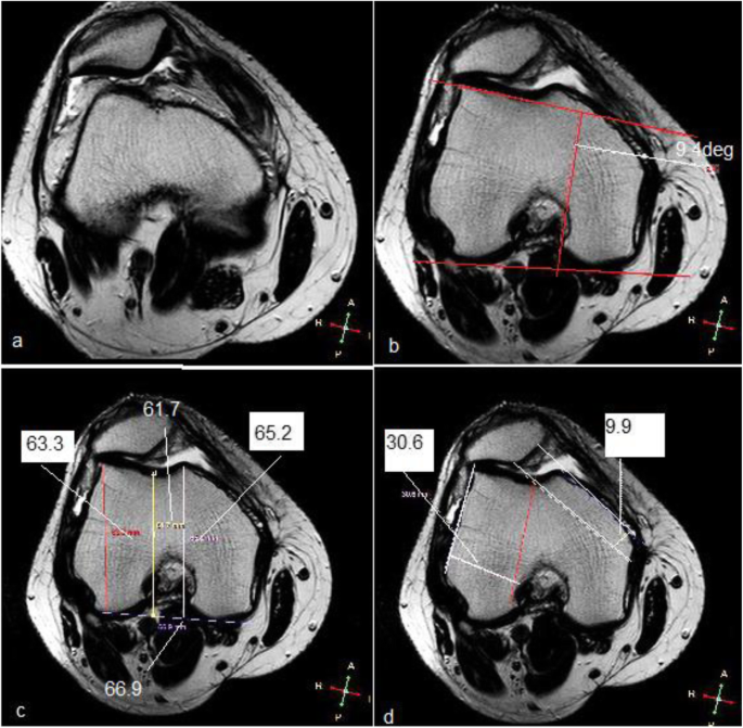 figure 14