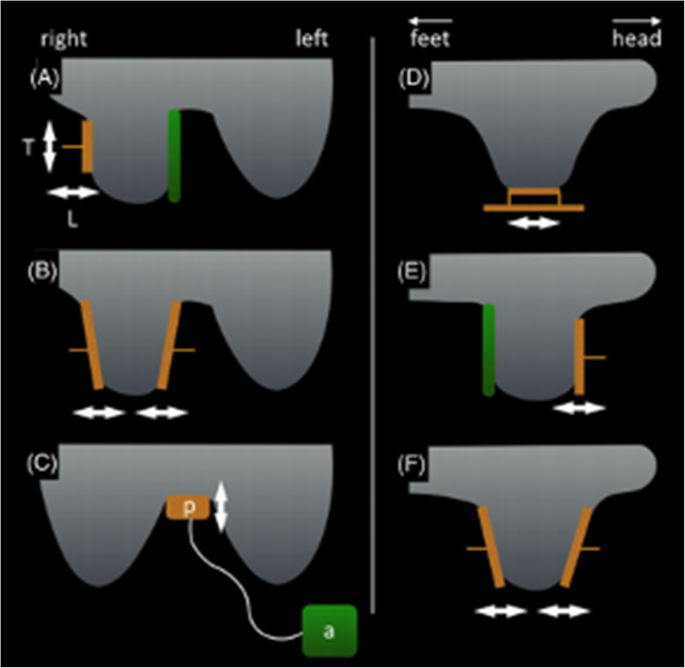 figure 14