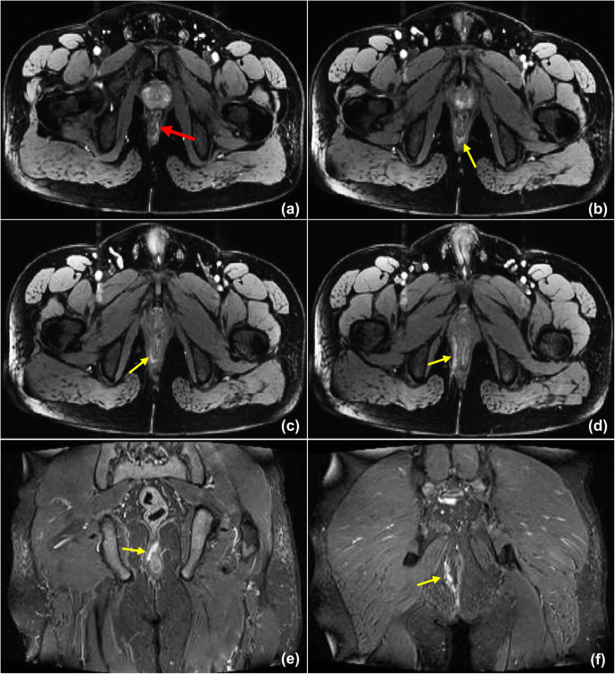 figure 16