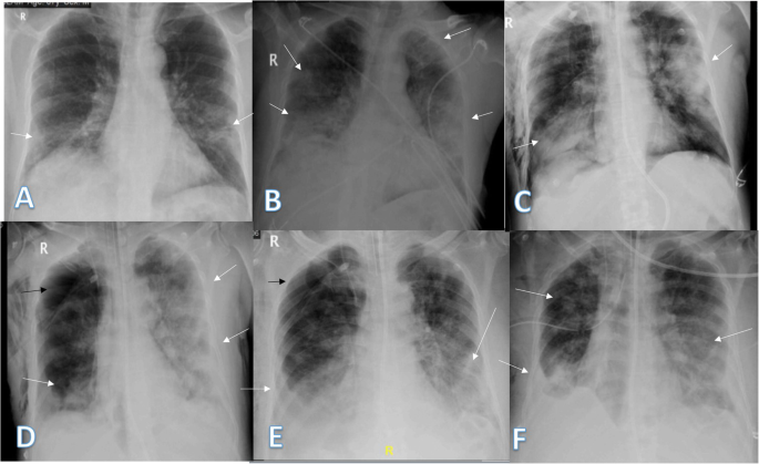 figure 18