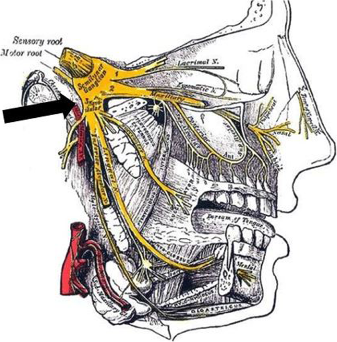 figure 14