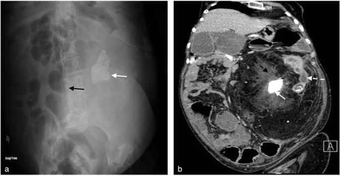 figure 16