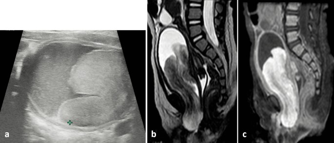 figure 15