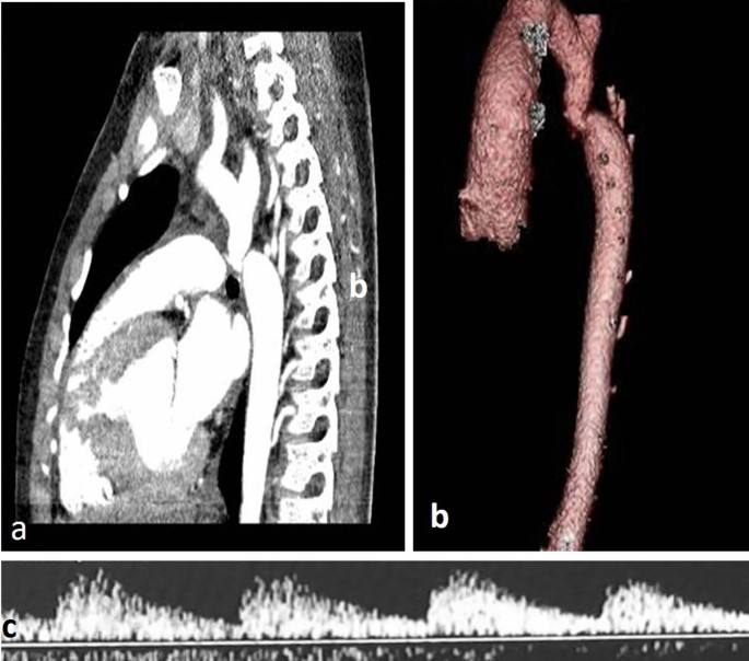 figure 19