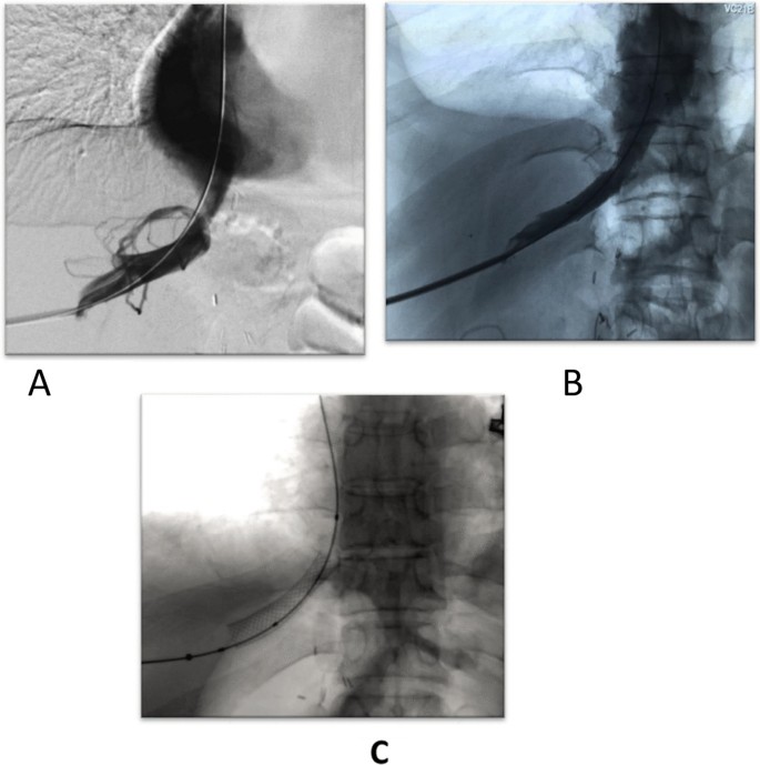 figure 14