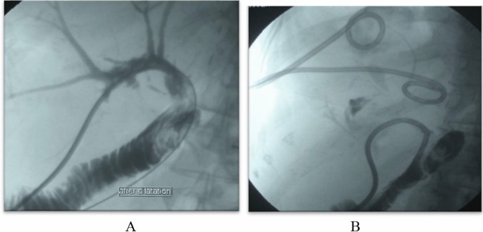 figure 19