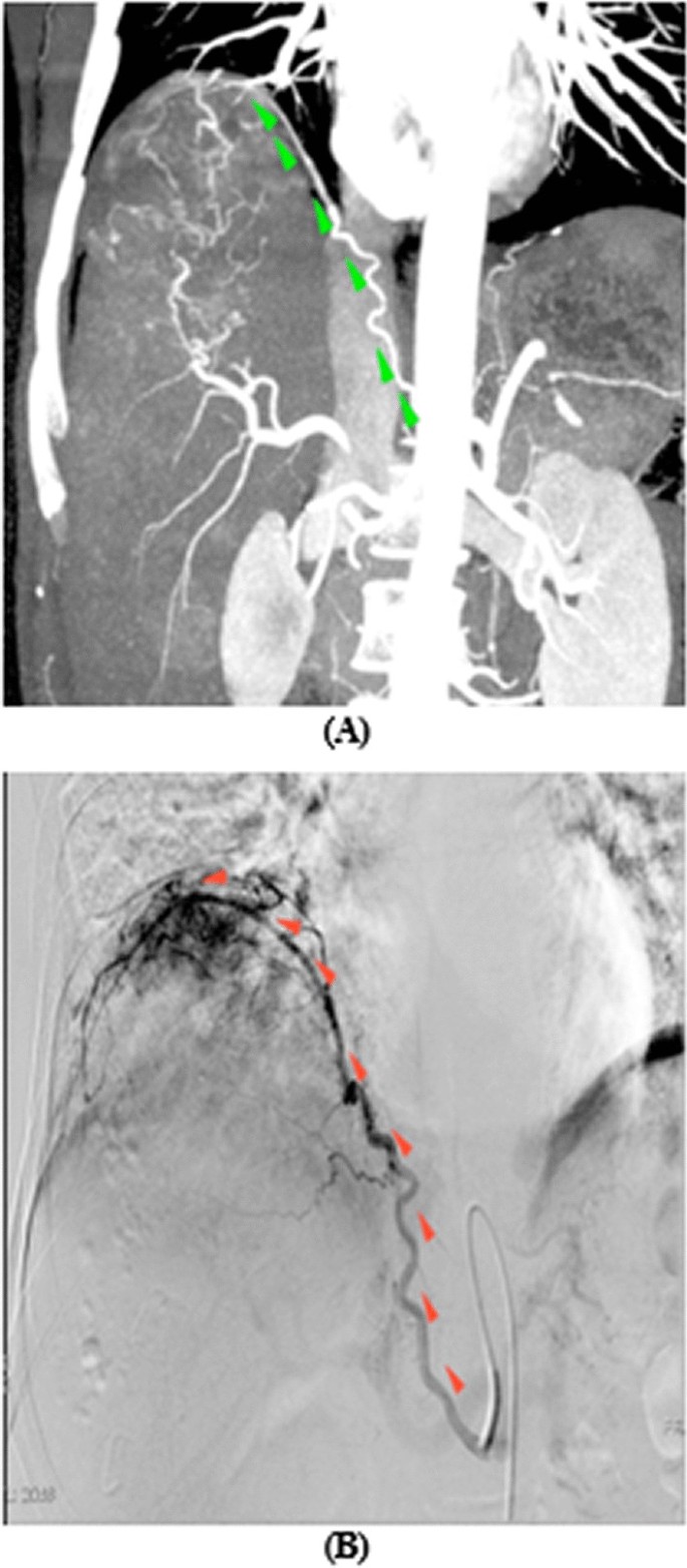 figure 9