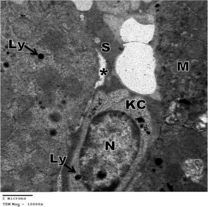 figure 29