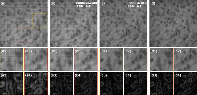 Meta Microscope Transformer-based neural network enabled subpixel-resolution in wide ...