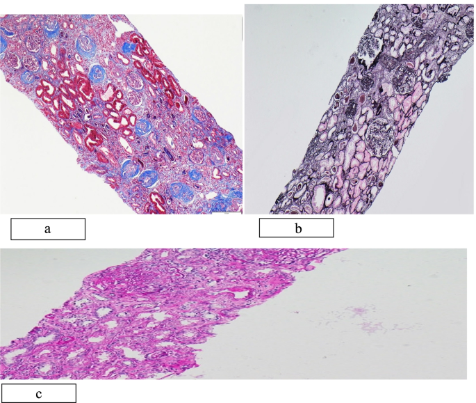 figure 16