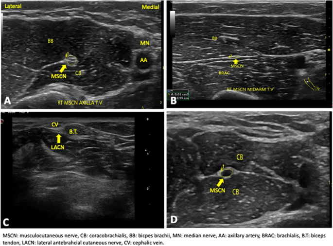 figure 17