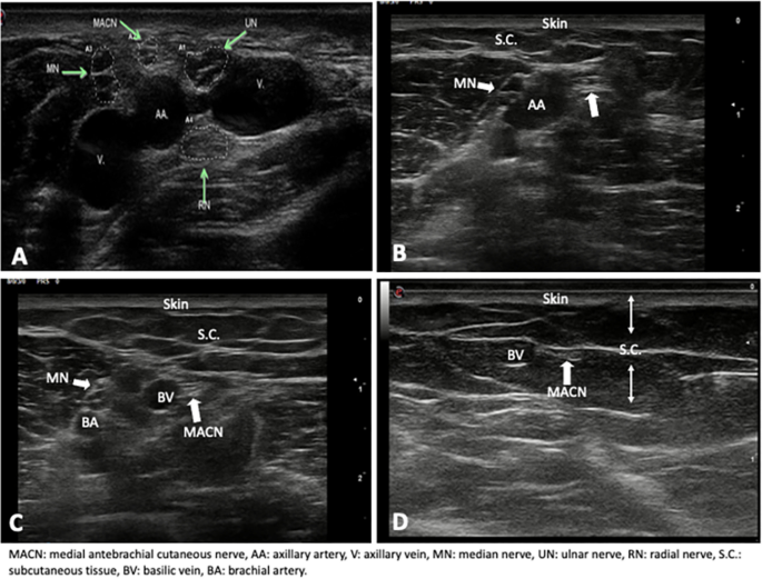 figure 22