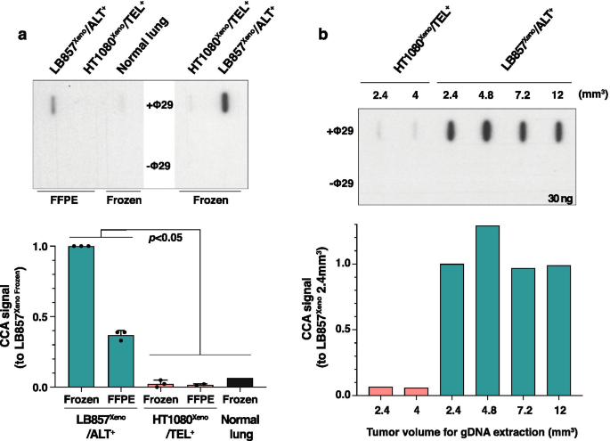 Detection of alternative lengthening of telomeres mechanism on tumor  sections | SpringerLink