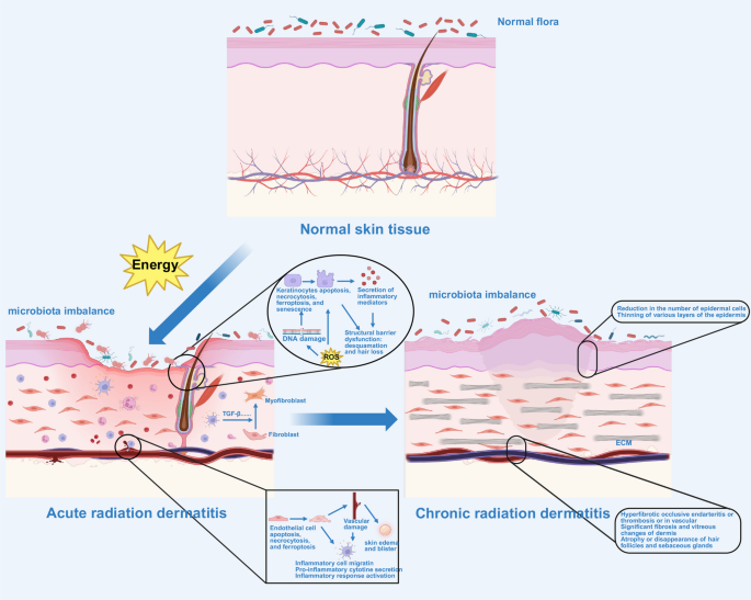 Ionizing radiation: molecular mechanisms, biological effects, and  therapeutic targets | Molecular Biomedicine | Springer Nature Link