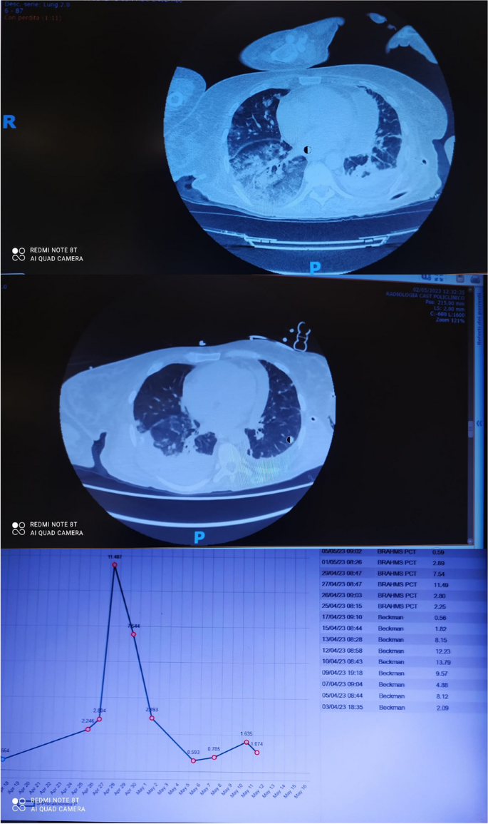 figure 65