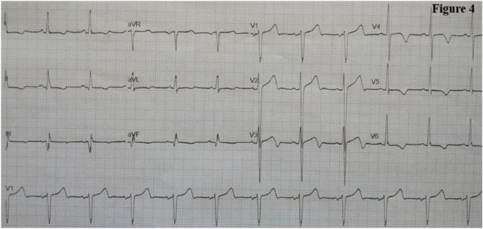 figure 24