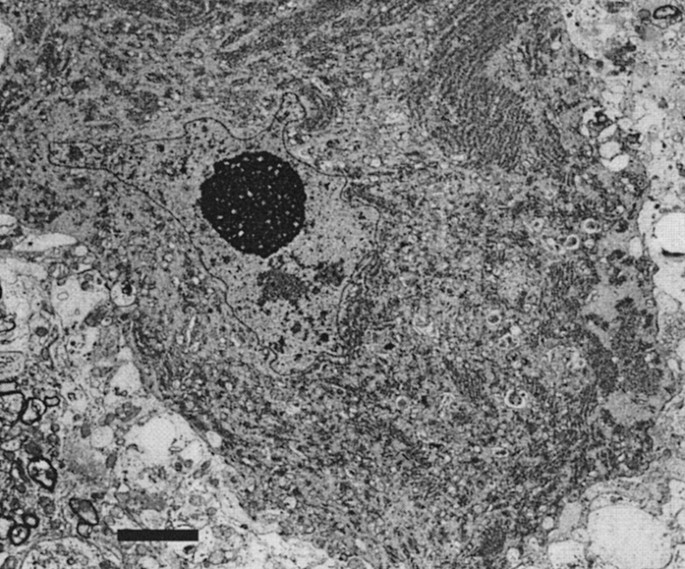 Inherited Motor  Neuron  Disease  in Domestic Cats  A Model 