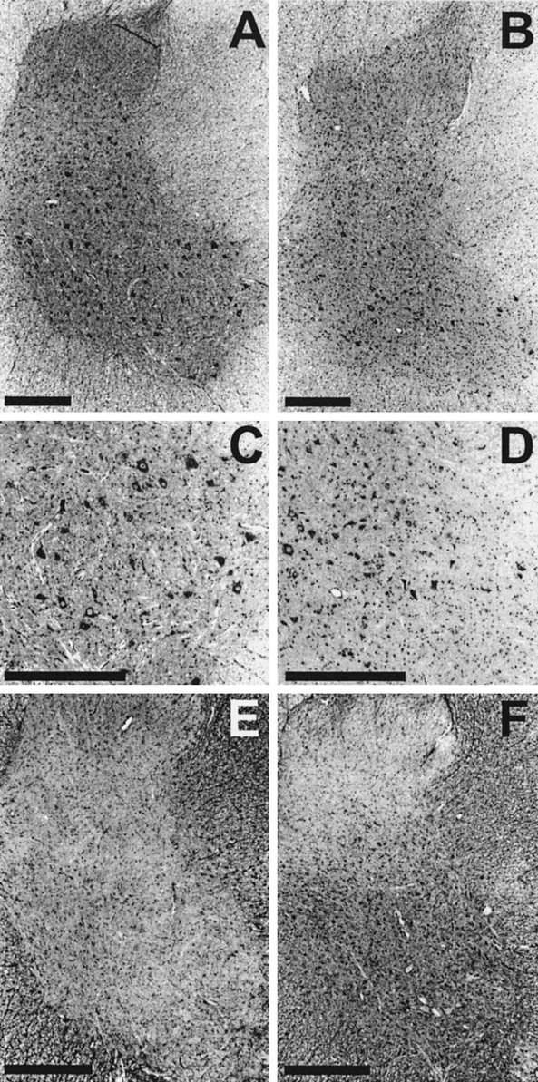 Inherited Motor  Neuron  Disease  in Domestic Cats  A Model 