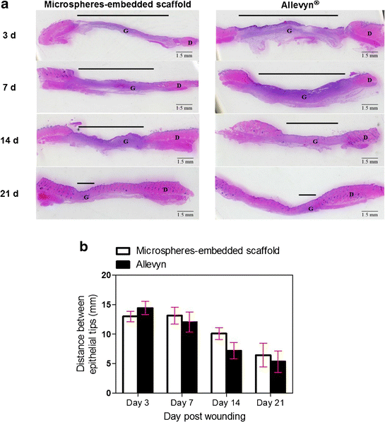 Controlled Release Of Chitosan And Sericin From The Microspheres Embedded Wound Dressing For The Prolonged Anti Microbial And Wound Healing Efficacy Springerlink