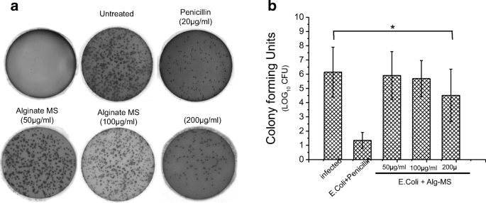 Alginate Microspheres Elicit Innate M1 Inflammatory Response In Macrophages Leading To Bacillary Killing Springerlink