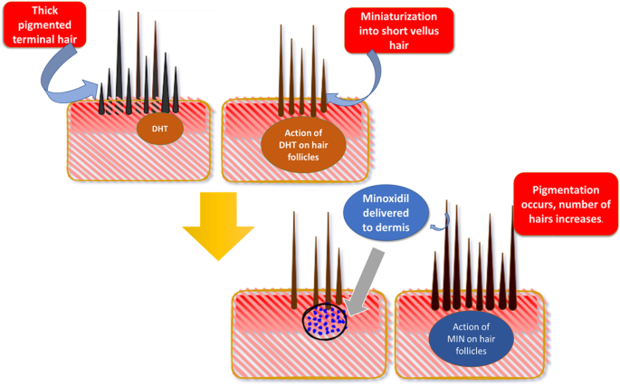 Nanodrug Delivery Strategies to Signaling Pathways in Alopecia