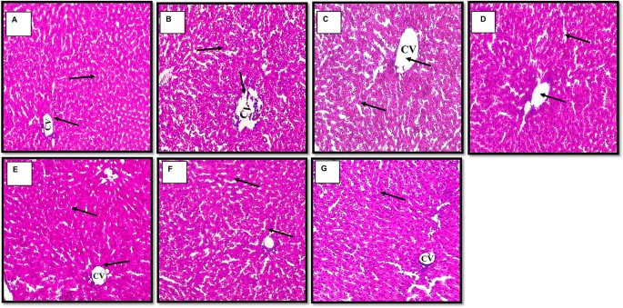 sublingual delivery glp-1 receptor agonists Sublingual Delivery of Human GLP-1 Loaded Nanoliposomal Hydrogel for  Treatment of Type 2 Diabetes Mellitus | AAPS PharmSciTech