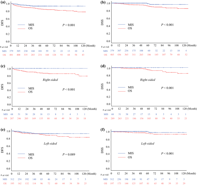 Minimally Invasive Versus Open Pancreatectomy For Right Sided And Left Sided G1 G2 Nonfunctioning Pancreatic Neuroendocrine Tumors A Multicenter Matched Analysis With An Inverse Probability Of Treatment Weighting Method Springerlink Minimally Invasive Versus Open Pancreatectomy For Right Sided And Left Sided G1 G2 Nonfunctioning Pancreatic Neuroendocrine Tumors A Multicenter Matched Analysis With An Inverse Probability Of Treatment Weighting Method Springerlink