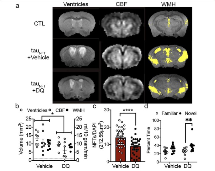 Translating the Biology of Aging into New Therapeutics for Alzheimer's Disease: Senolytics | The Journal of Prevention of Alzheimer's Disease