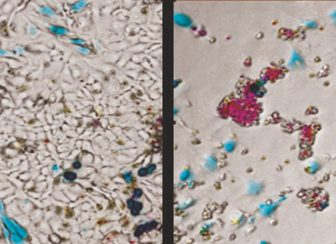 Oncolytic adenovirus expressing bispecific antibody targets T‐cell ...