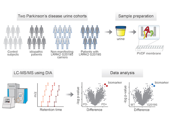 Urinary proteome profiling for stratifying patients with familial ...