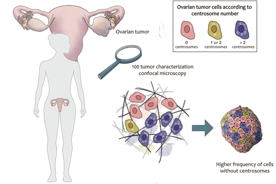 A catalog of numerical centrosome defects in epithelial ovarian cancers ...