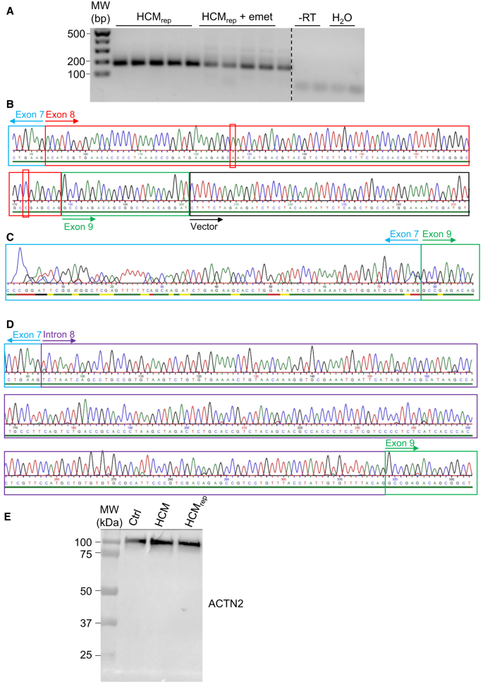 Disease modeling of a mutation in α‐actinin 2 guides clinical therapy ...