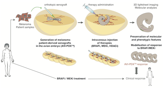 An in vivo avian model of human melanoma to perform rapid and robust ...