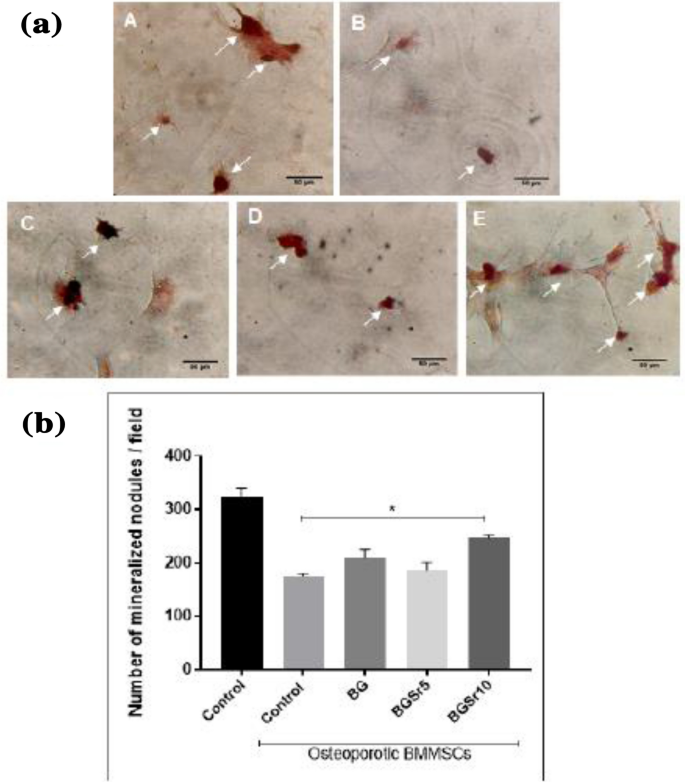 Strontium Releasing Sol Gel Bioactive Glass Spheres And Their Ability To Stimulate Osteogenic Differentiation In Osteoporotic Bone Marrow Mesenchymal Stem Cells Springerlink