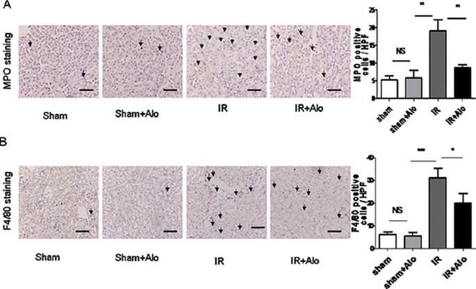 Aloperine Protects Mice against Ischemia-Reperfusion (IR)-Induced Renal  Injury by Regulating PI3K/AKT/mTOR Signaling and AP-1 Activity | Molecular  Medicine | Full Text