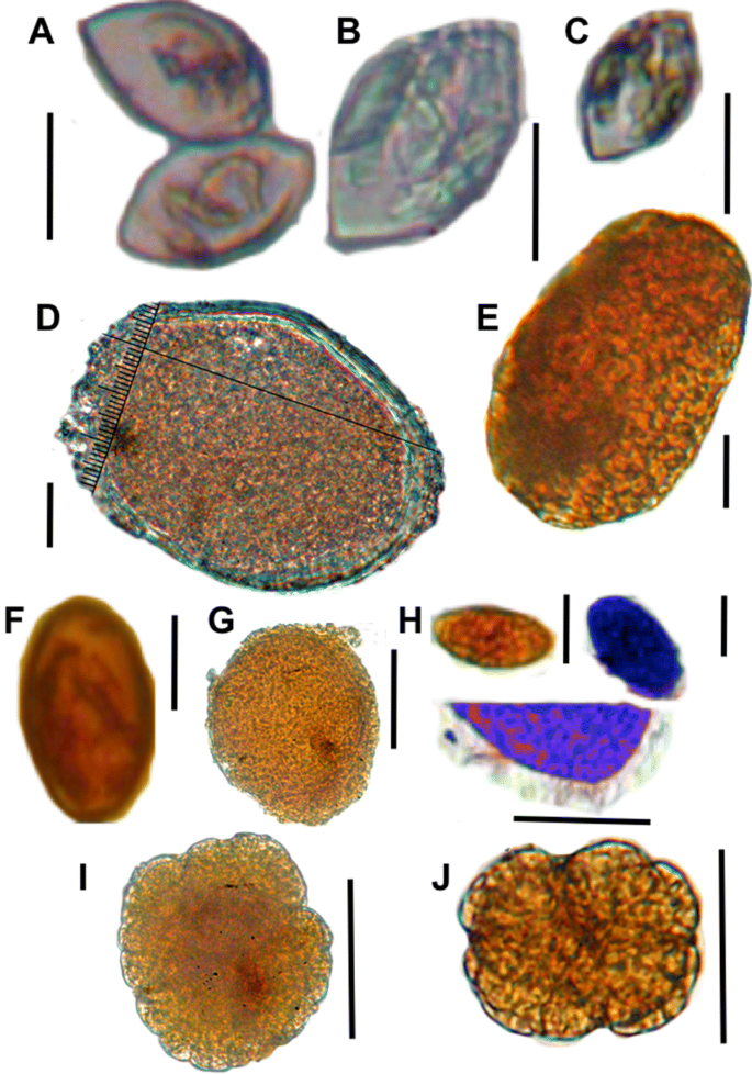 PDF) First report of a helminth infection for Bryde's whale Balaenoptera  edeni Anderson, 1878 (Cetacea, Balaenopteridae)