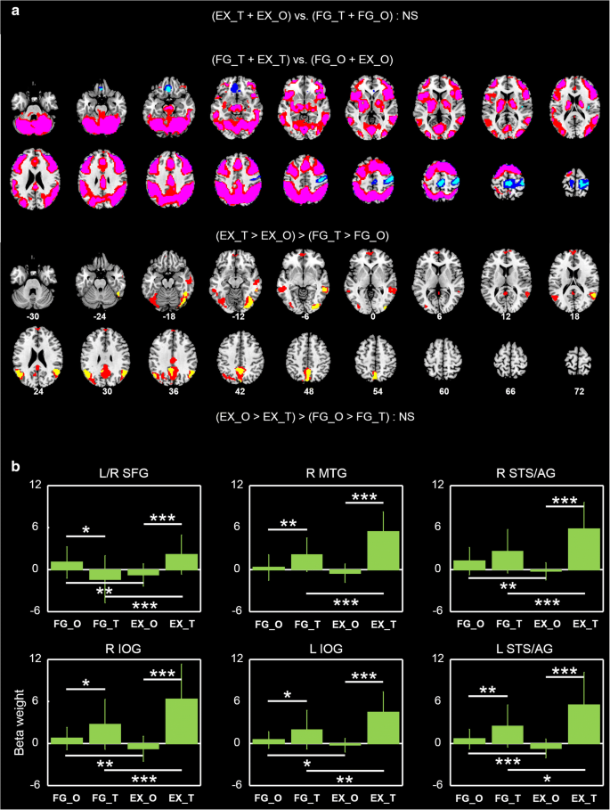 Cerebral Responses To Self Initiated Action During Social Interactions Springerlink Cerebral Responses To Self Initiated Action During Social Interactions Springerlink