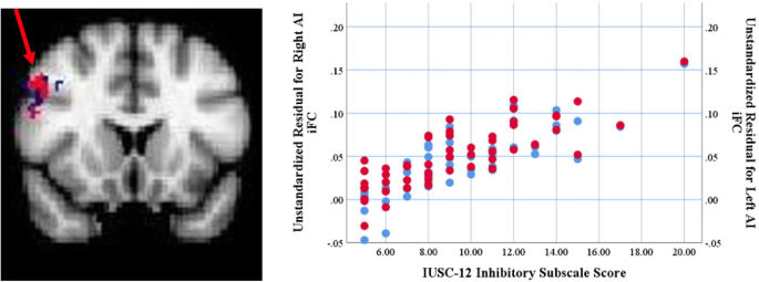 File:Enhanced functional connectivity of insula in high elo action