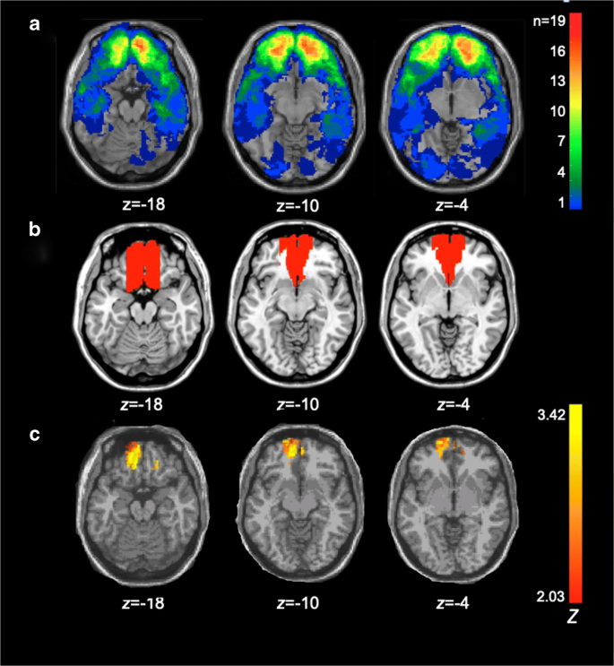 Neural underpinning of a personal relationship with God and sense of  control: A lesion-mapping study | SpringerLink