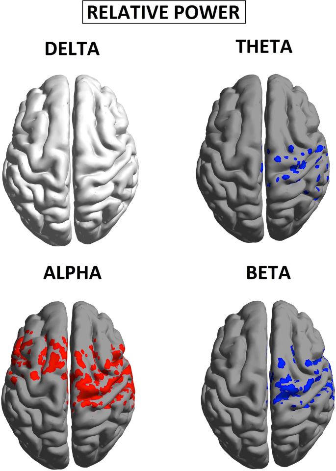 Altered brain structural and functional connectivity in cannabis users