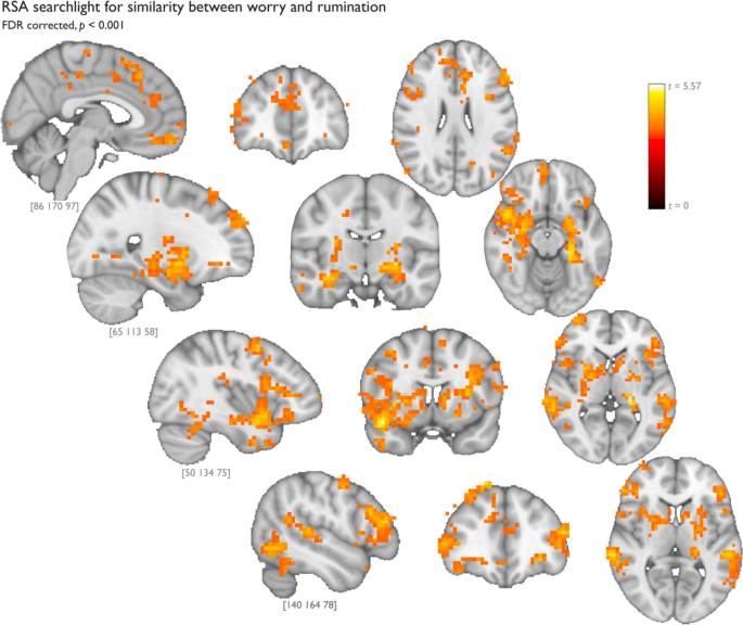 Worry and rumination elicit similar neural representations 