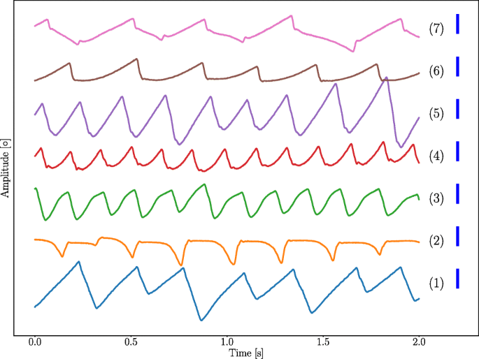 A Robust Method For Calibration Of Eye Tracking Data Recorded During Nystagmus Springerlink calibration of eye tracking data