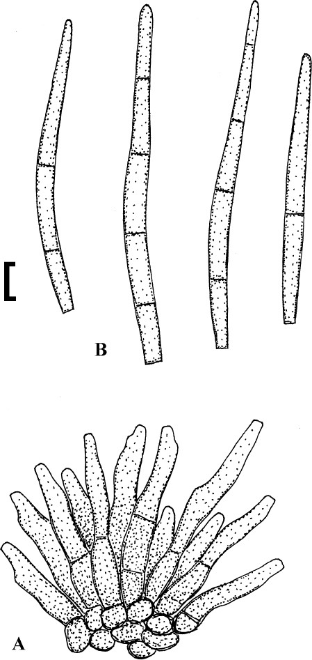 figure 113