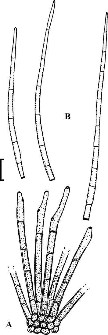 figure 44