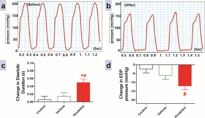 Hinokitiol for hypertensive emergencies: effects on peripheral ...