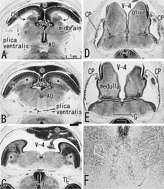 Early fetal development of the human cerebellum | SpringerLink