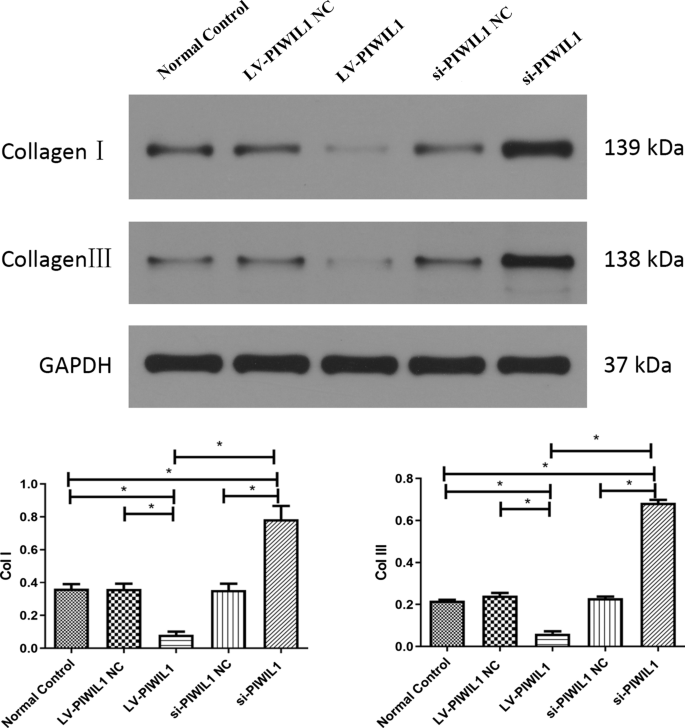 imagej western blot quantification imagej western blot quantification
