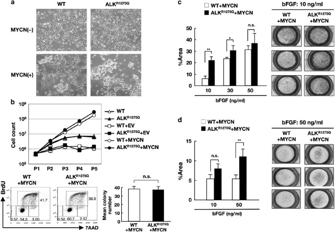 ALK R1275Q perturbs extracellular matrix, enhances cell 