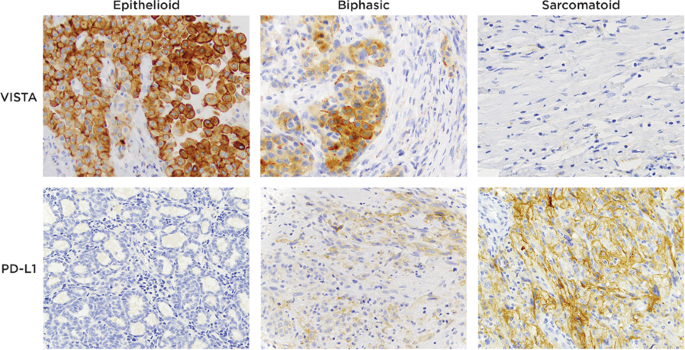 Inside the USCAP Journals | Modern Pathology