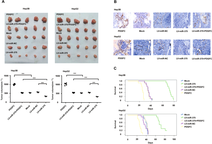 MicroRNA-375 represses tumor angiogenesis and reverses 